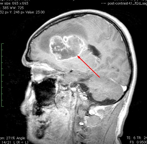 ffa3d5d0c2e06f2eacfca334175931a6.jpg