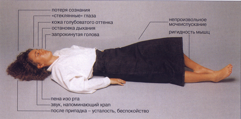 Эпилепсия.jpg